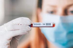 Qué obras sociales cubren test Covid-19